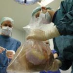 Don d’organes : sept familles sur dix refusent le prélèvement