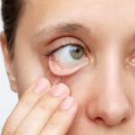 Anémie infantile : l’OMS souligne les dangers pour le développement cognitif et physique