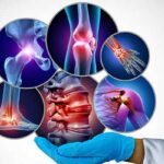 Tunisie : la fibromyalgie, un syndrome complexe marqué par douleurs, fatigue et troubles du sommeil