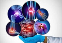 Tunisie : la fibromyalgie, un syndrome complexe marqué par douleurs, fatigue et troubles du sommeil