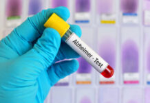 Mémoire et Alzheimer : que révèle un nouveau biomarqueur sanguin ?